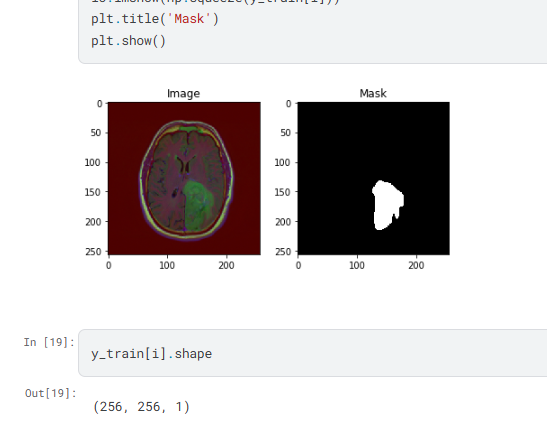 Brain Tumor Segmentation from MRI using PSPNet